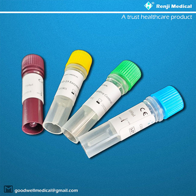 Resultados nuevos de Kit Complete de la prueba del antígeno de Coronavirus del CE 40-90 minutos