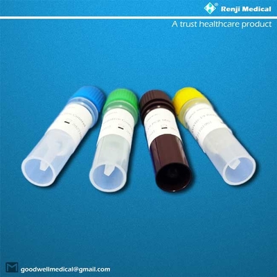 Polimerización en cadena en tiempo real Kit With Sputum Specimens de prueba ácido nucléico del RT