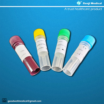 Muestra nasal del equipo de Renji Rt Pcr Test Home/orofaríngea anterior